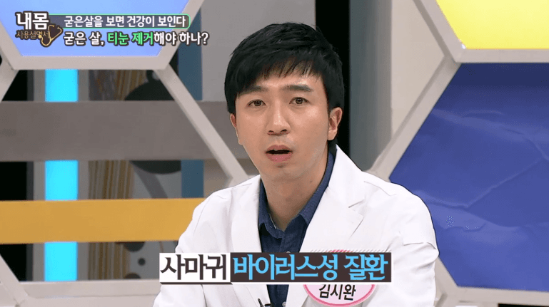 양성 종양