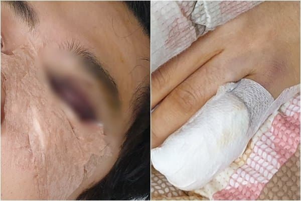 "예비 신랑이 층간소음으로 폭행을 당했습니다"(+ 사진有)