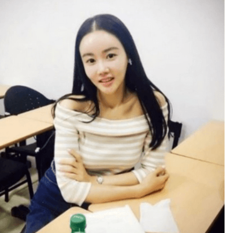 탈모인 1000만 시대, 여성 탈모 원인 및 초기 치료법