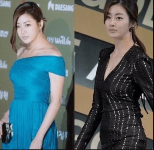 한소희도 겪었던 거북목, 하루 3분으로 예방하는 법