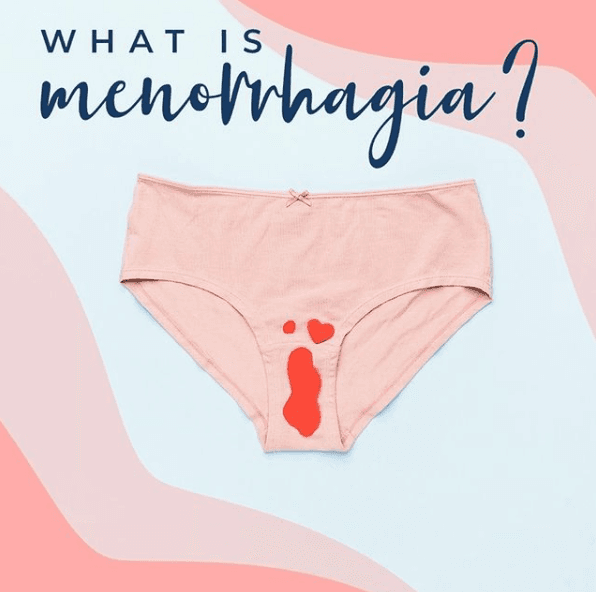 이유없는 부정출혈, 알고보니 생리대가 문제였다?
